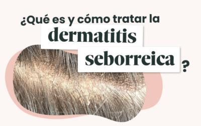 ¿Qué es y cómo tratar la dermatitis seborreica?