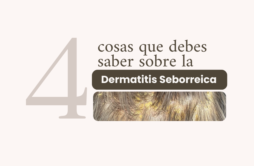 4 cosas que debes saber sobre la Dermatitis Seborreica